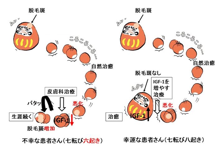 円形脱毛症　病院